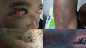 西藏康区炉霍县百姓无故遭警察毒打